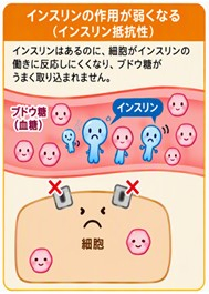 インスリン抵抗性.jpg
